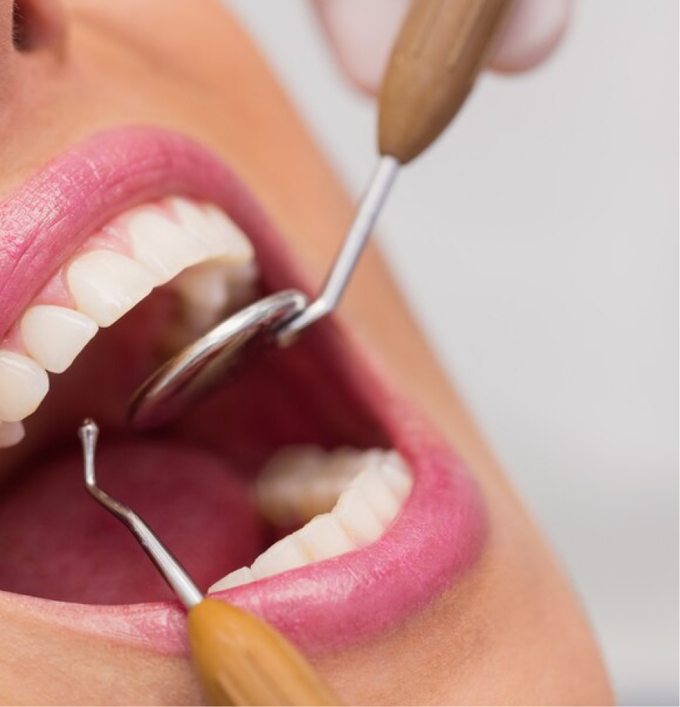 Dentist examining a patient's teeth using a mouth mirror and dental probe