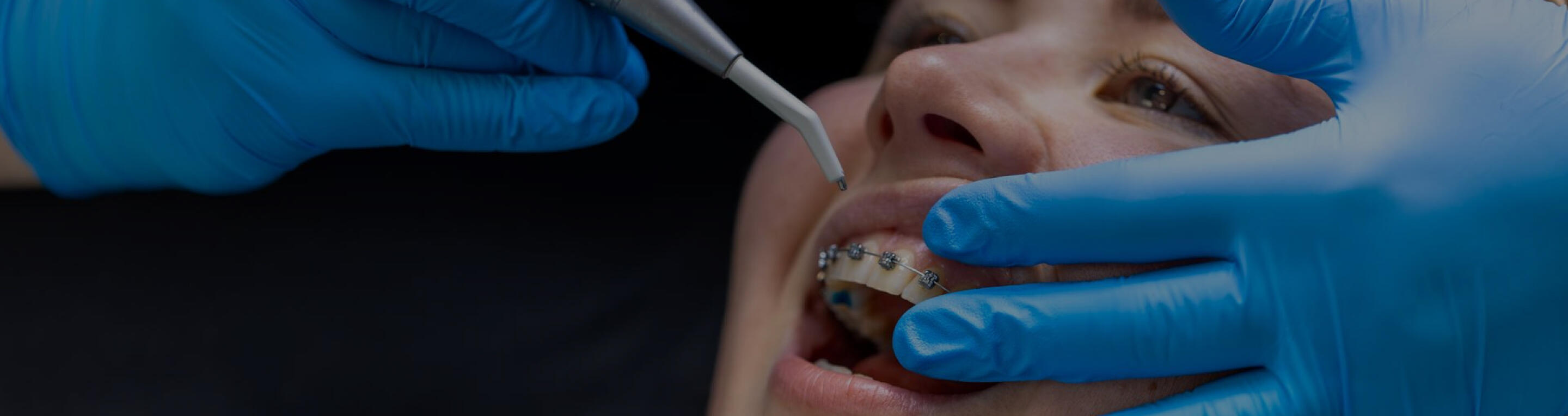 orthodontics