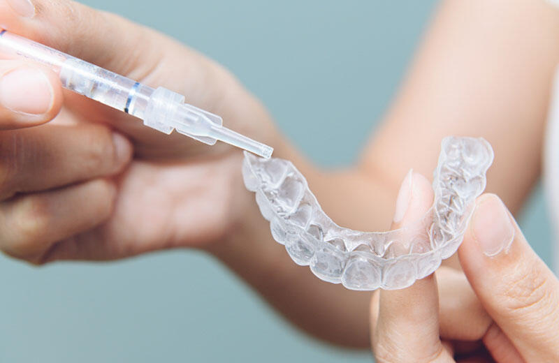 Invisible aligners being placed on teeth for clear orthodontic treatment and discreet teeth straightening