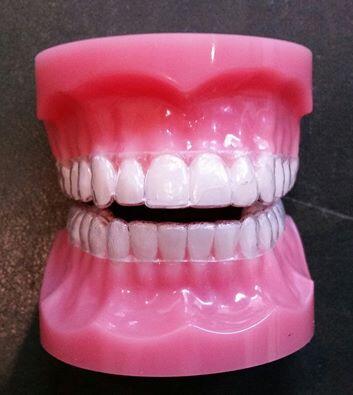 Clear Invisible aligners