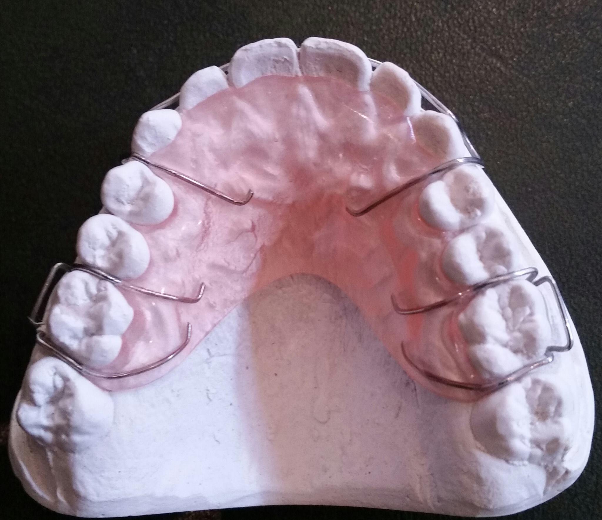 upper removable plate