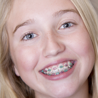 Smiling young girl with metal braces on her teeth during orthodontic treatment for straighter smile