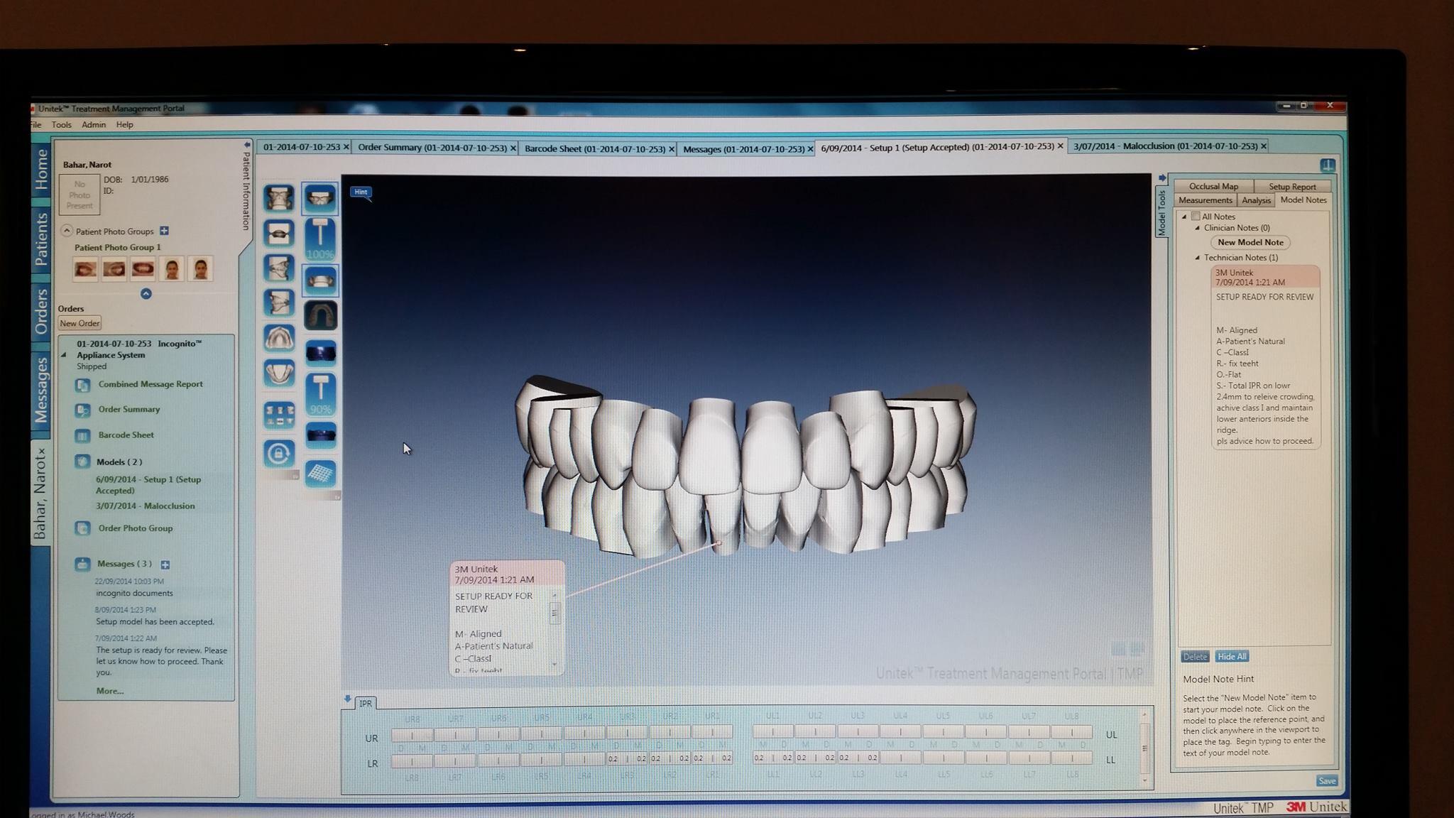 Clincheck Digital set-up