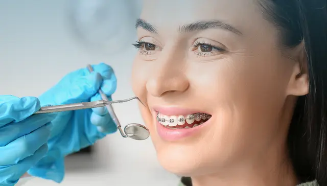 Braces Treatment Options Available in Armadale