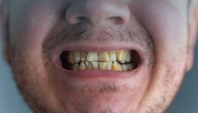 Dentist performing gum disease treatment for healthy gums in Armadale