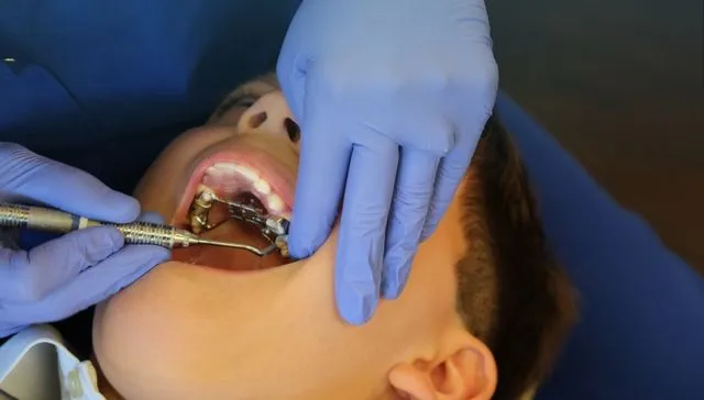 Orthodontic Emergency in Armadale